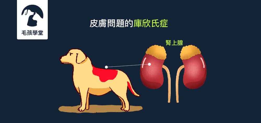 內分泌失調也會造成皮膚問題的庫欣氏症